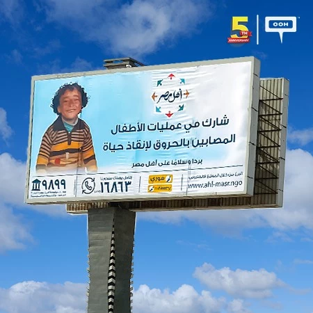 Ahl Masr Foundation Encourages People to Donate in Order to Save Child Burn Victims